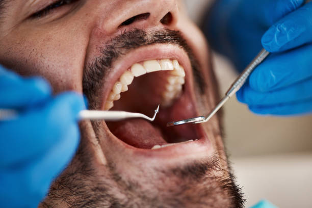 Best Tooth Extraction  in Closter, NJ